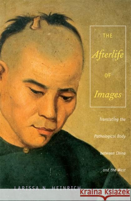 The Afterlife of Images: Translating the Pathological Body Between China and the West Heinrich, Ari Larissa 9780822340935 Duke University Press - książka