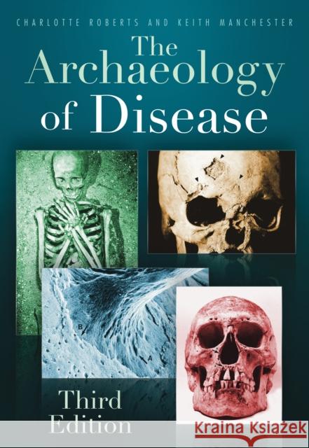 The Archaeology of Disease: Third Edition Charlotte Roberts 9780752457505 The History Press Ltd - książka