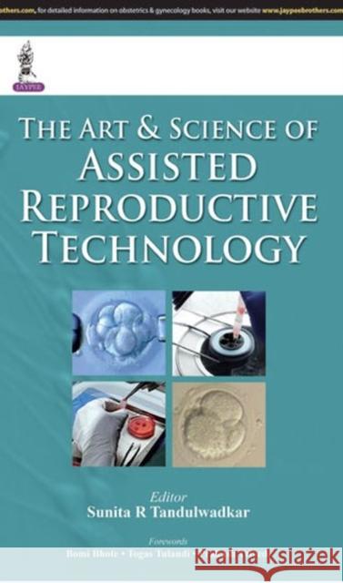 The Art & Science of Assisted Reproductive Technology Sunita R Tandulwadkar   9789351524755 Jaypee Brothers Medical Publishers - książka