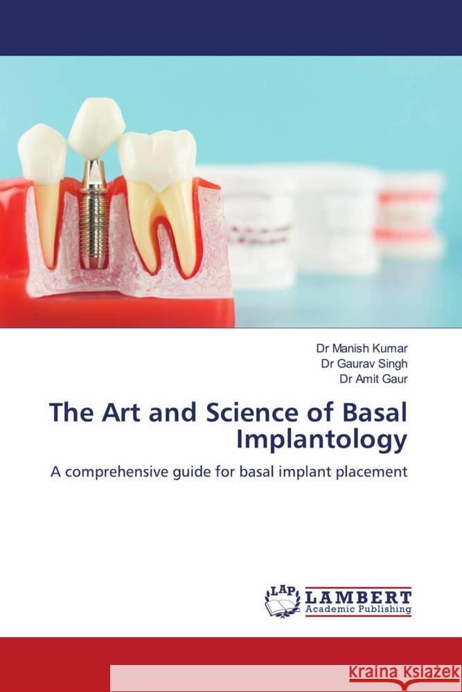The Art and Science of Basal Implantology Manish Kumar Gaurav Singh Amit Gaur 9783659930669 LAP Lambert Academic Publishing - książka
