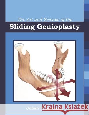 The Art and Science of the Sliding Genioplasty Johan P. Reyneke 9781948083133 Raeducation.com LLC Publications - książka