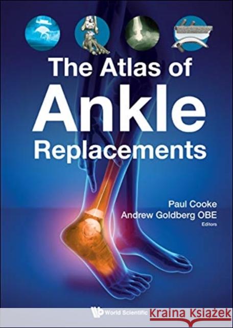 The Atlas of Ankle Replacements Andrew Goldberg Paul Cooke 9781786346230 Wspc (Europe) - książka
