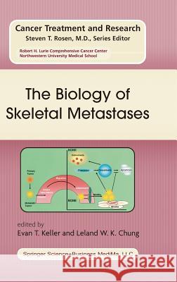 The Biology of Skeletal Metastases Evan T. Keller Leland W. K. Chung Evan T. Keller 9781402077494 Kluwer Academic Publishers - książka