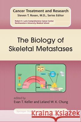The Biology of Skeletal Metastases Evan T. Keller Leland W. K. Chung 9781461348030 Springer - książka