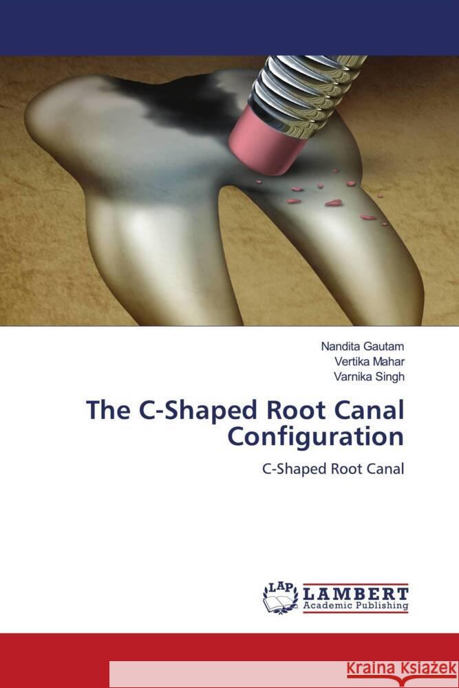 The C-Shaped Root Canal Configuration Gautam, Nandita, Mahar, Vertika, Singh, Varnika 9786205491508 LAP Lambert Academic Publishing - książka