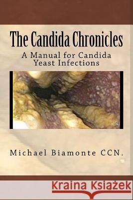 The Candida Chronicles: A Mannual for Candida/Yeast Infections Michael C. Biamont 9780692756195 Michael Biamonte - książka