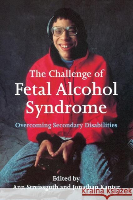 The Challenge of Fetal Alcohol Syndrome: Overcoming Secondary Disabilities Streissguth, Ann 9780295976501 University of Washington Press - książka