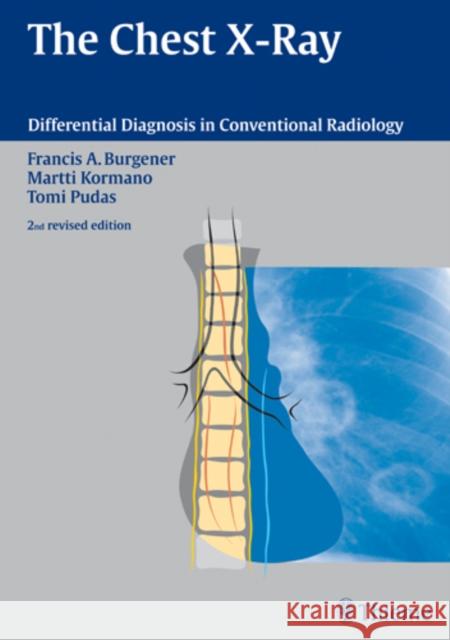 The Chest X-Ray Francis A. Burgener Martti Kormano Tomi Pudas 9783131076120 Thieme Publishing Group - książka