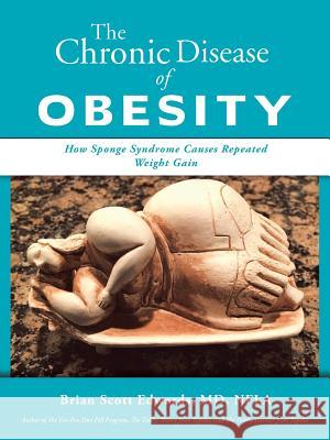 The Chronic Disease of Obesity: How Sponge Syndrome Causes Repeated Weight Gain Brian Scott Edwards 9781532041426 iUniverse - książka