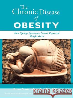 The Chronic Disease of Obesity: How Sponge Syndrome Causes Repeated Weight Gain Brian Scott Edwards Fnla, MD 9781532060557 iUniverse - książka