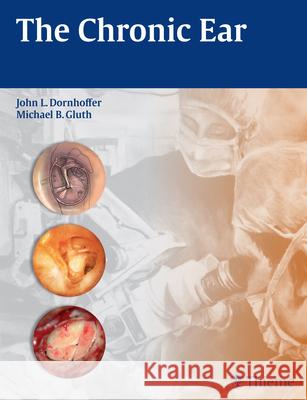 The Chronic Ear John L. Dornhoffer Michael B. Gluth John L. Dornhoffer 9781604068641 Thieme Medical Publishers - książka