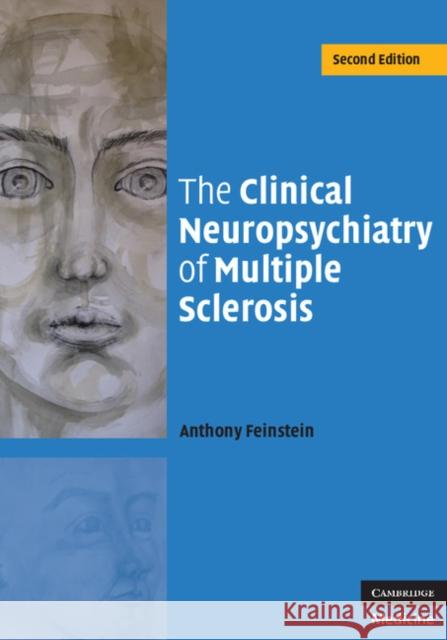 The Clinical Neuropsychiatry of Multiple Sclerosis Anthony Feinstein 9780521852340  - książka