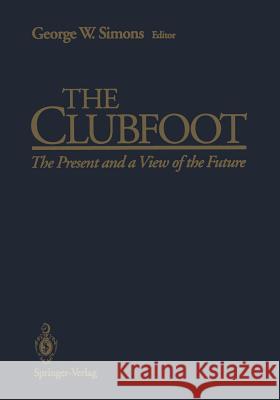 The Clubfoot: The Present and a View of the Future Tachdjian, M. O. 9781461392712 Springer - książka