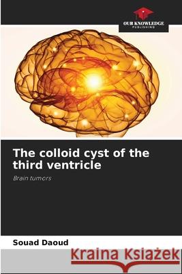 The colloid cyst of the third ventricle Souad Daoud 9786205389652 Our Knowledge Publishing - książka