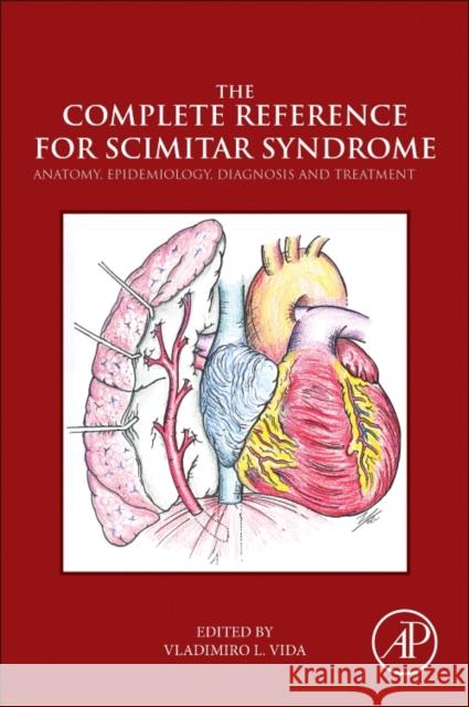 The Complete Reference for Scimitar Syndrome: Anatomy, Epidemiology, Diagnosis and Treatment Vladimiro Vida 9780128104064 Academic Press - książka