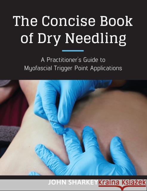 The Concise Book of Dry Needling: A Practitioner's Guide to Myofascial Trigger Point Applications John Sharkey 9781623170837 North Atlantic Books,U.S. - książka