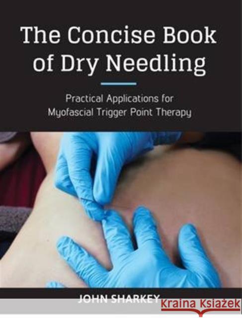 The Concise Book of Dry Needling: Practical Applications for Myofascial Trigger Point Therapy John Sharkey 9781905367672 Lotus Publishing Limited - książka