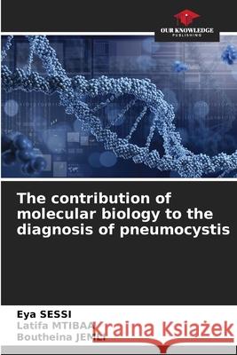 The contribution of molecular biology to the diagnosis of pneumocystis SESSI, Eya, Mtibaa, Latifa, Jemli, Boutheina 9786208786861 Our Knowledge Publishing - książka
