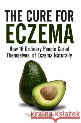 The Cure for Eczema Ewan M Cameron 9781785550393 Inspired Publications - książka