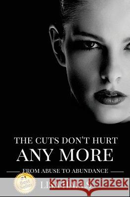 The Cuts Don't Hurt Anymore: From Abuse To Abundance McClung, John, Jr. 9781537327235 Createspace Independent Publishing Platform - książka