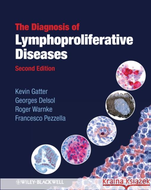 The Diagnosis of Lymphoproliferative Diseases Kevin Gatter Georges Delsol Roger Warnke 9781405170147 Wiley-Blackwell (an imprint of John Wiley & S - książka