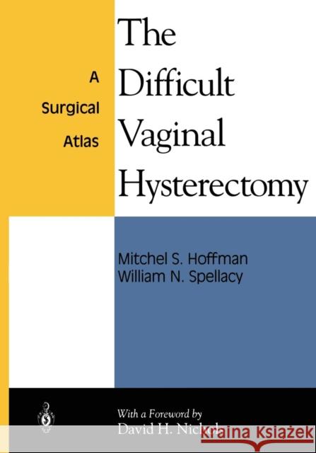 The Difficult Vaginal Hysterectomy: A Surgical Atlas Hoffman, Mitchel S. 9781475743258 Springer - książka