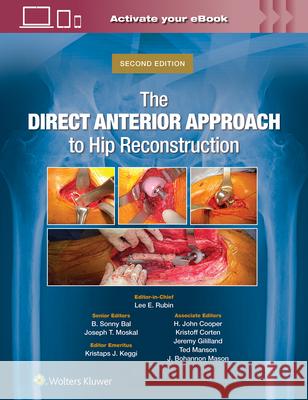 The Direct Anterior Approach to Hip Reconstruction Lee E. Rubin B. Sonny Bal Joseph T. Moskal 9781975221973 LWW - książka