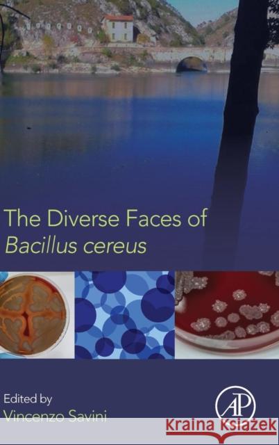 The Diverse Faces of Bacillus Cereus Savini, Vincenzo   9780128014745 Elsevier Science - książka