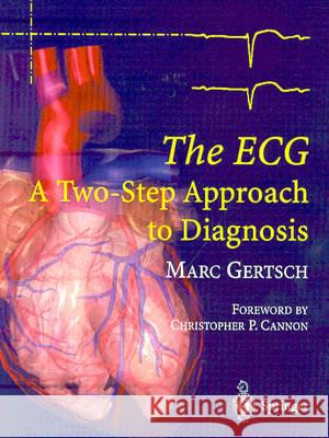 The ECG: A Two-Step Approach to Diagnosis Cannon, C. P. 9783540008699 Springer - książka