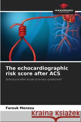 The echocardiographic risk score after ACS Menzou, Farouk 9786206818243 Our Knowledge Publishing - książka