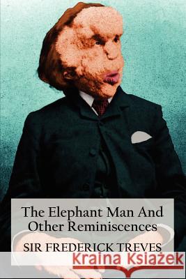 The Elephant Man and Other Reminiscences Treves, Frederick 9781781391808 Benediction Classics - książka