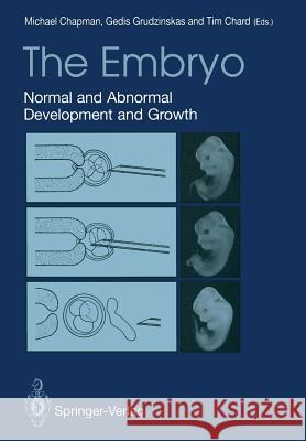 The Embryo: Normal and Abnormal Development and Growth Chapman, Michael G. 9781447118046 Springer - książka