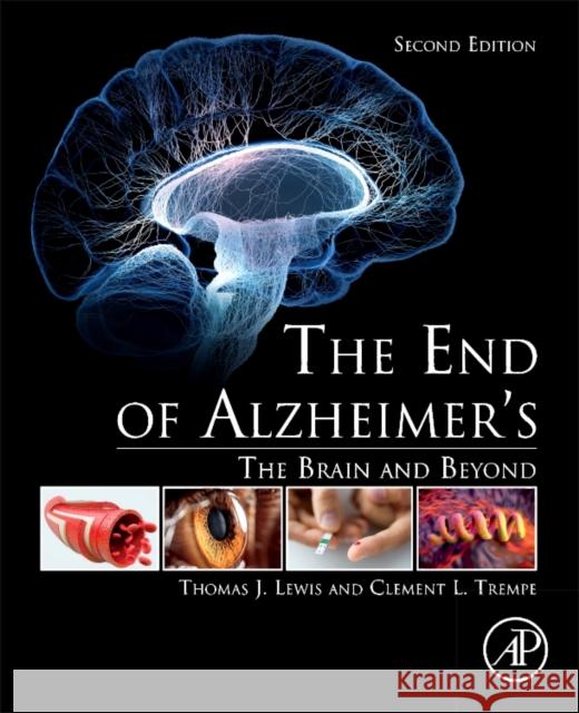 The End of Alzheimer's: The Brain and Beyond Lewis, Thomas J. 9780128121122 Academic Press - książka