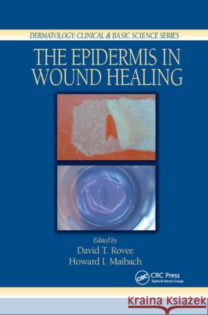 The Epidermis in Wound Healing David T. Rovee Howard I. Maibach 9780367394639 CRC Press - książka