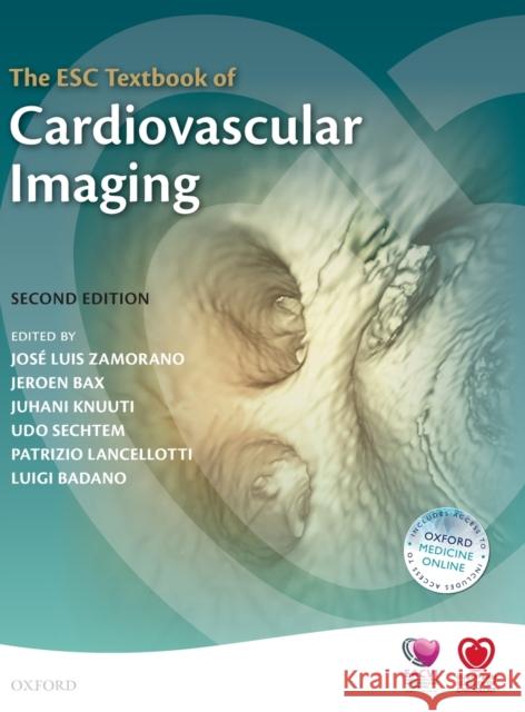 The Esc Textbook of Cardiovascular Imaging Zamorano, Jose Luis 9780198703341 OXFORD UNIVERSITY PRESS ACADEM - książka