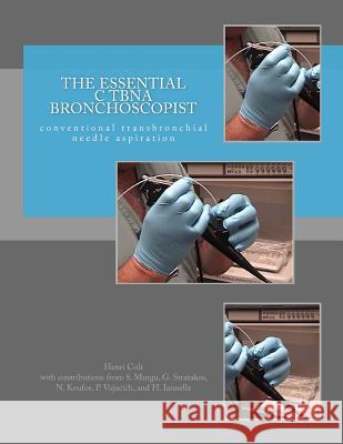 The Essential cTBNA Bronchoscopist: conventional TransBronchial Needle Aspiration Murgu, Septimiu 9781517342692 Createspace - książka