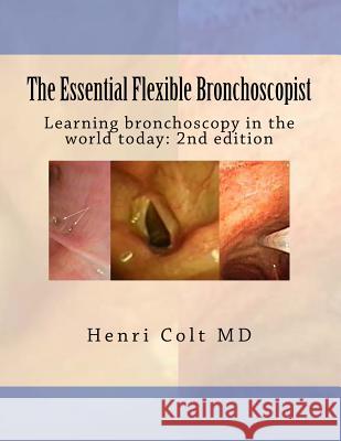 The Essential Flexible Bronchoscopist: Learning bronchoscopy in the world today Colt, Henri 9781517270896 Createspace - książka