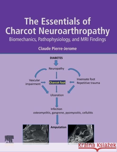 The Essentials of Charcot Neuroarthropathy: Biomechanics, Pathophysiology, and MRI Findings Pierre-Jerome, Claude 9780323993524 Elsevier - książka