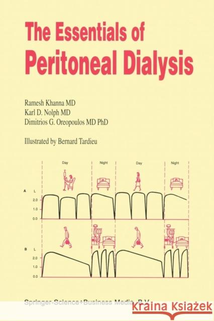 The Essentials of Peritoneal Dialysis R. Khanna K. D. Nolph Dimitrios G. Oreopoulos 9789401052238 Springer - książka