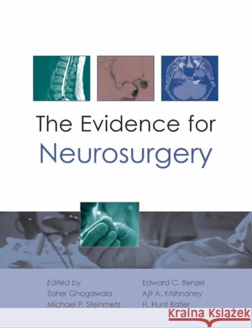 The Evidence for Neurosurgery Ghogawala, Zoher 9781903378793  - książka