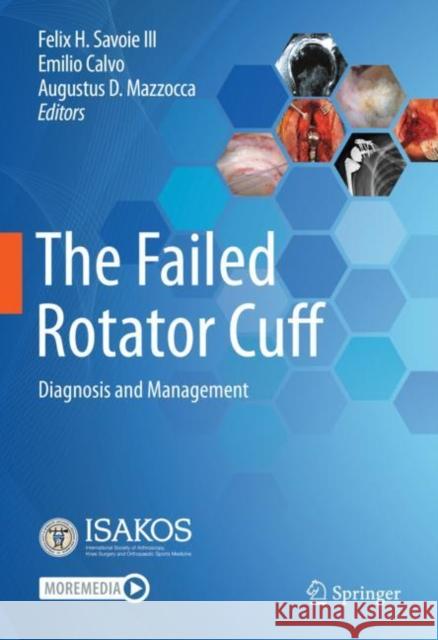 The Failed Rotator Cuff: Diagnosis and Management Felix H. Savoi Emilio Calvo Augustus Mazzocca 9783030794804 Springer - książka