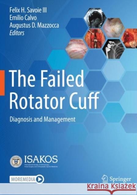 The Failed Rotator Cuff: Diagnosis and Management Felix H. Savoi Emilio Calvo Augustus D. Mazzocca 9783030794835 Springer - książka