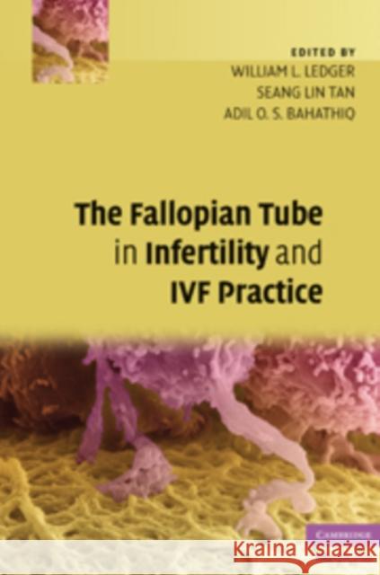 The Fallopian Tube in Infertility and IVF Practice William L Ledger 9780521873789  - książka