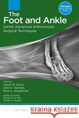 The Foot and Ankle: AANA Advanced Arthroscopic Surgical Techniques James W. Stone Kennedy G. John Mark Glazebrook 9781617119989 Slack - książka
