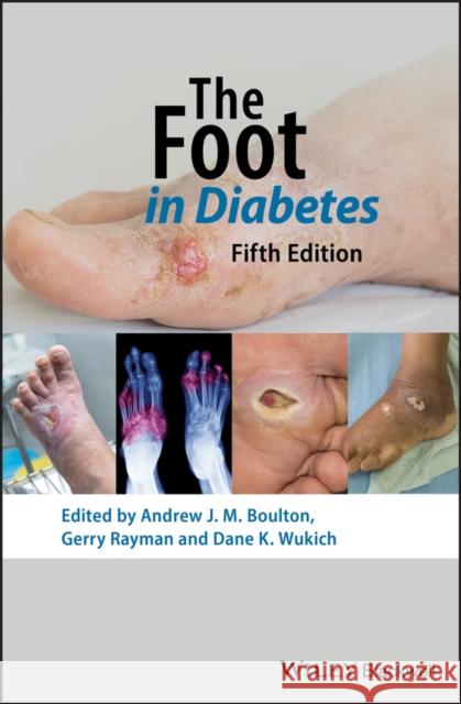 The Foot in Diabetes Andrew J. M. Boulton   9781119445814 Wiley-Blackwell (an imprint of John Wiley & S - książka