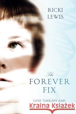 The Forever Fix: Gene Therapy and the Boy Who Saved It Ricki Lewis 9781250015778  - książka