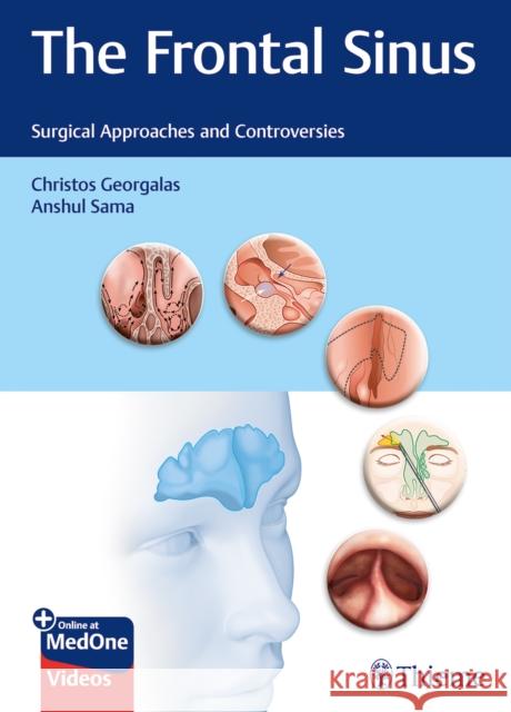 The Frontal Sinus: Surgical Approaches and Controversies Christos Georgalas Anshul Sama 9783132400528 Thieme Medical Publishers - książka