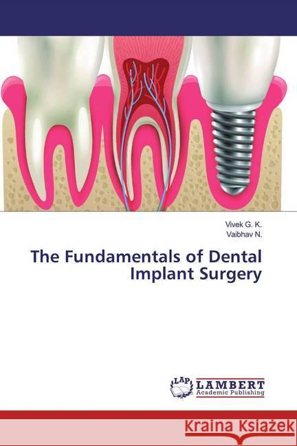 The Fundamentals of Dental Implant Surgery G. K., Vivek; N., Vaibhav 9786139461981 LAP Lambert Academic Publishing - książka