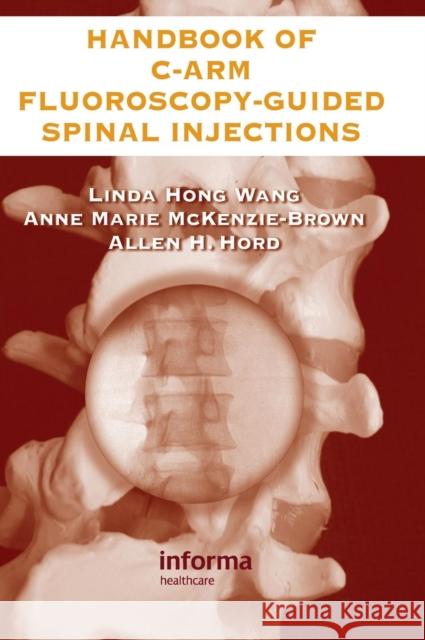 The Handbook of C-Arm Fluoroscopy-Guided Spinal Injections Linda Hong Wang Anne Marie McKenzie-Brown Allen H. Hord 9780849322549 CRC Press - książka