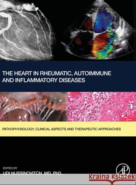 The Heart in Rheumatic, Autoimmune and Inflammatory Diseases: Pathophysiology, Clinical Aspects and Therapeutic Approaches Nussinovitch, Udi 9780128032671 Academic Press - książka